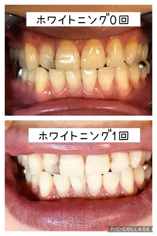 ホワイトニング🦷 ネイル💅LEAのその他イメージ