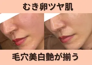 メンズ 【BUB立川】 ゆかのエステ・リラクイメージ