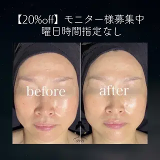 小顔マッサージ🌙 Hiyoriのエステ・リラクイメージ