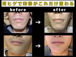 メンズ脱毛サロン Reyz（レイズ）のエステ・リラクイメージ