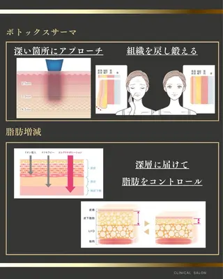 たるみほうれい線ケア 看護師サロンのエステ・リラクイメージ