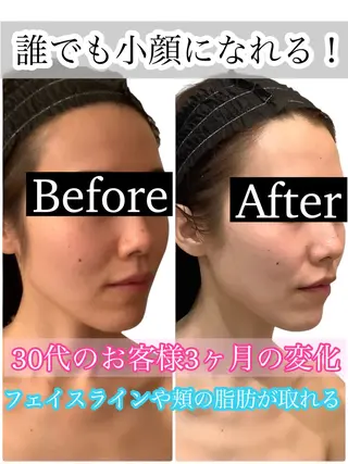 痩身ダイエット&小顔 🩷アールズスリムのエステ・リラクイメージ