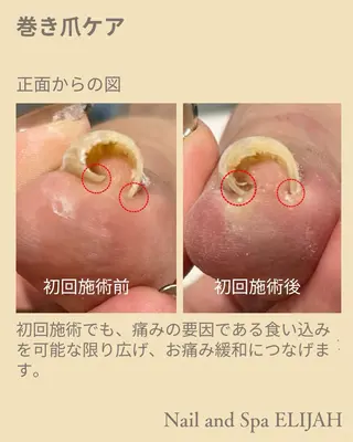 ネイル ダンラップ新里 友簣乃のネイルデザイン
