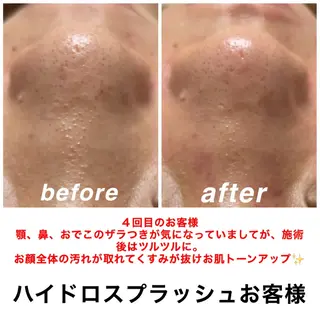 ネイル・エステサロン UILANIのエステ・リラクイメージ