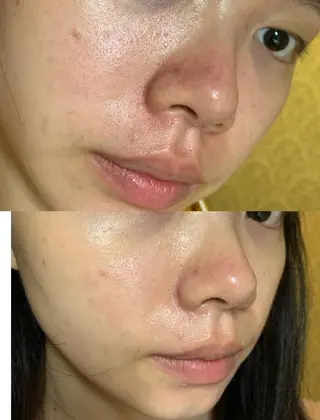 愛維美水光専門店 川崎彩鳳のエステ・リラクイメージ