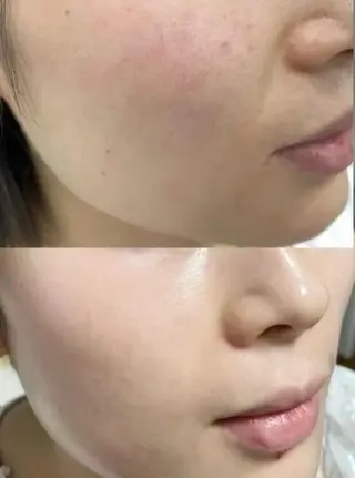 カラー 愛維美水光専門店 川崎彩鳳のエステ・リラクイメージ