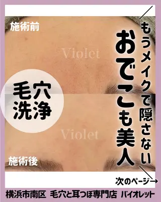 毛穴と耳つぼ専門店 バイオレット　りののその他イメージ