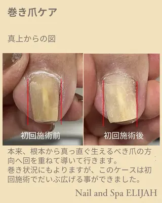 ネイル ダンラップ新里 友簣乃のネイルデザイン