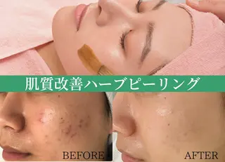 肌質改善サロン BestBelleのエステ・リラクイメージ