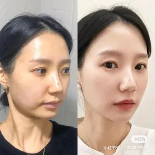 愛維美水光専門店 川崎彩鳳のエステ・リラクイメージ