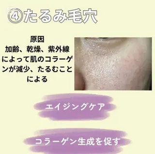 愛維美水光美肌専門店 メンズレディースokのエステ・リラクイメージ