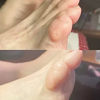 ネイル 巻き爪・肥厚爪ケア 専門サンセリテのネイルデザイン