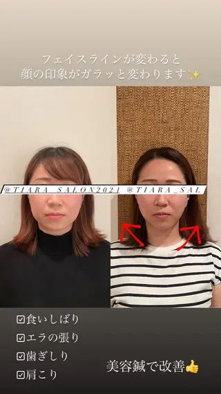 セミロング カラー パーマ ヘアアレンジ メンズ キッズ ネイル マツエク・マツパ アイブロウ 鍼灸サロン TIARA　美容鍼のエステ・リラクイメージ
