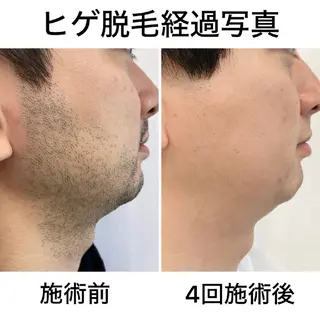 メンズ キッズ 脱毛*エステ*リラク 猫の手【丸田和可子】のエステ・リラクイメージ