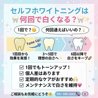 ホワイトニング ショップ葵区静岡駅店のその他イメージ