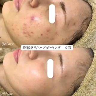 肌質改善サロン renew/ウエキのエステ・リラクイメージ