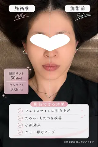 マツエク・マツパ 愛維美水光美肌専門店 メンズレディースokのエステ・リラクイメージ