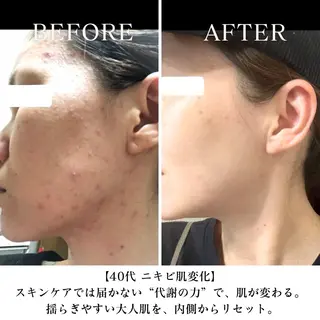【三軒茶屋/下馬】 本格痩身・よもぎ蒸しのエステ・リラクイメージ