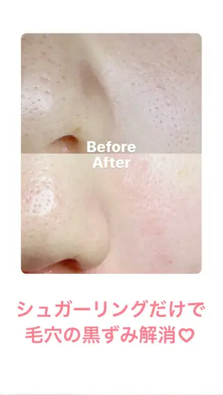 豊橋 |Hitomi シュガーリング専門店のその他イメージ