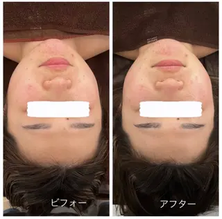 Relaxsalon undoのエステ・リラクイメージ