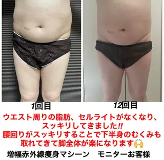 ネイル・エステサロン UILANIのエステ・リラクイメージ