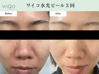 北村悠 【予防美容ENQU】のエステ・リラクイメージ