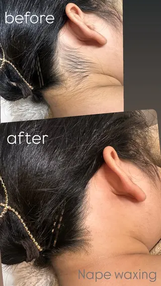 なみ|WAX脱毛専門 店|さいたま市のエステ・リラクイメージ