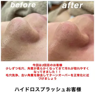 ネイル・エステサロン UILANIのエステ・リラクイメージ