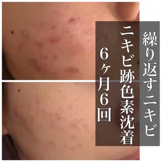 ミディアム カラー パーマ ヘアアレンジ メンズ キッズ ネイル マツエク・マツパ ニキビ・肌質改善専門 ♡人生が変わるサロンのエステ・リラクイメージ