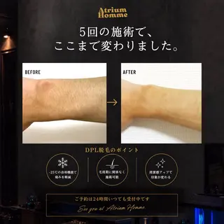 メンズ 恵比寿/アイブロウ/ 脱毛/Tatsuyaの眉毛・アイブロウイメージ
