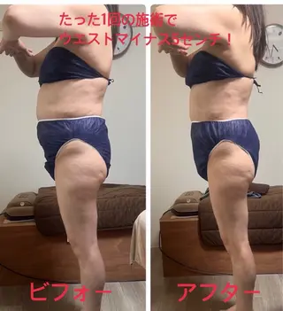 所沢 痩身エステサロンのエステ・リラクイメージ