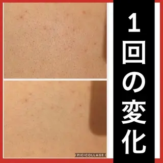 ミディアム カラー パーマ ヘアアレンジ メンズ キッズ ネイル マツエク・マツパ ニキビ・肌質改善専門 ♡人生が変わるサロンのエステ・リラクイメージ