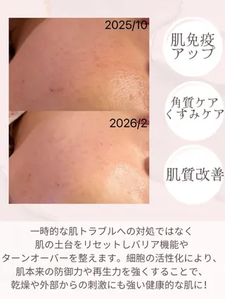 小顔&毛穴・肌質改善 LINDA西宮 AIのエステ・リラクイメージ