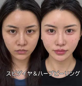 JUNA 健康美サロン渋谷店のエステ・リラクイメージ