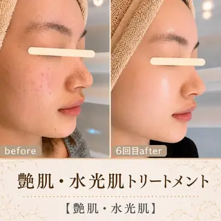 メンズ 最速小顔・肌管理 espoir 阿部のエステ・リラクイメージ