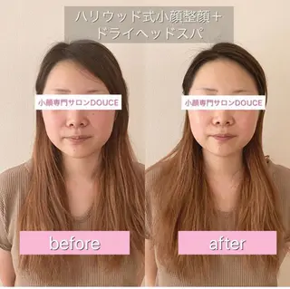 小顔＆美肌 Re :setのエステ・リラクイメージ