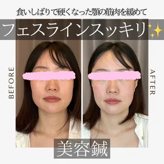 《美肌・小顔》美容鍼 &マッサージ*MEIのエステ・リラクイメージ