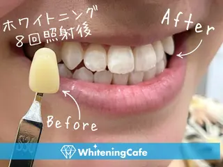 ホワイトニングカフェ 徳島沖浜店のその他イメージ