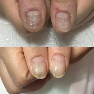 ネイル 自爪育成・巻き爪 補正講師 津蔵のネイルデザイン
