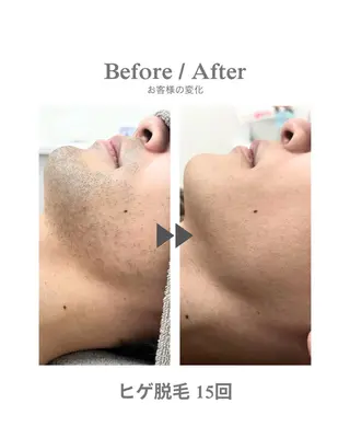 メンズ 脱毛&痩身エステ Narcisのエステ・リラクイメージ