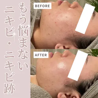 美肌サロン💎ハーブ ピーリング🌿ルプレのエステ・リラクイメージ