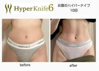 いわきり ゆきのエステ・リラクイメージ