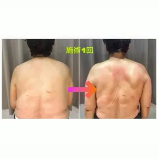 代表 MOMOのエステ・リラクイメージ