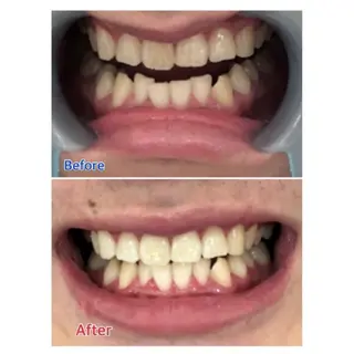 M渋谷 セルフホワイトニングのエステ・リラクイメージ