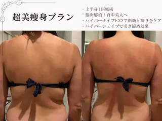 総合美容サロン LOVEME渋谷本店のエステ・リラクイメージ