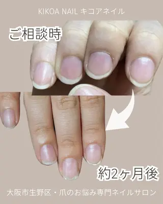ネイル KIKOA NAIL キコアネイルのネイルデザイン