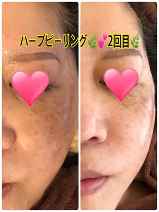 ❤️予約殺到❤️mi オールハンド痩身専門のエステ・リラクイメージ
