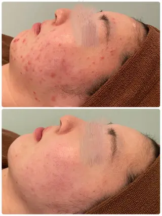 ハーブピーリング専門 BIOPLUS+川崎のエステ・リラクイメージ