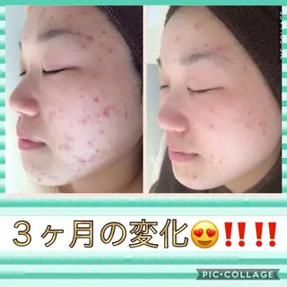 ミディアム カラー パーマ ヘアアレンジ メンズ キッズ ネイル マツエク・マツパ ニキビ・肌質改善専門 ♡人生が変わるサロンのエステ・リラクイメージ