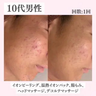 ニキビ・肌質改善専門 ♡人生が変わるサロンのエステ・リラクイメージ